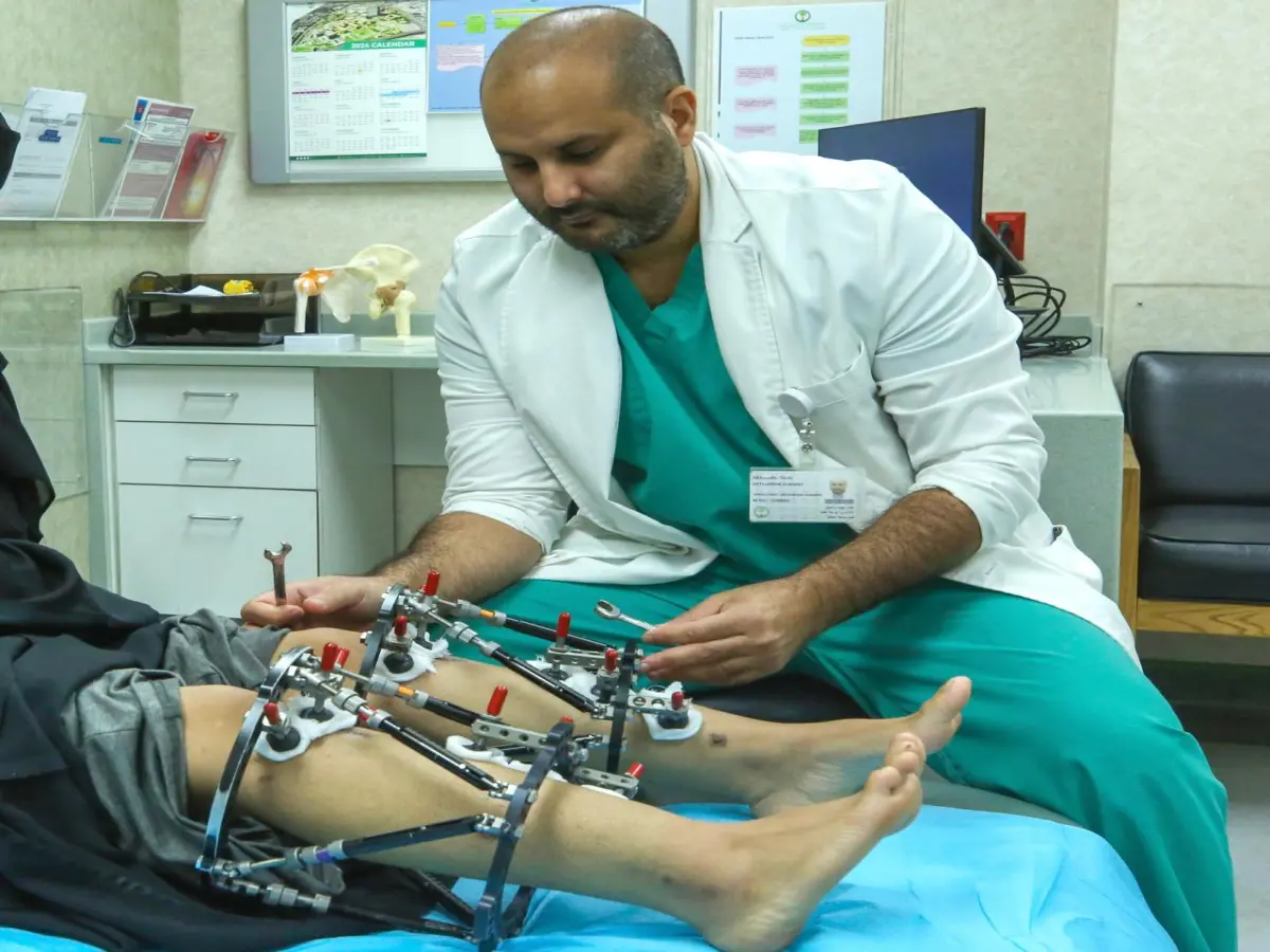 طرق إطالة العظام - المثبتات الخارجية