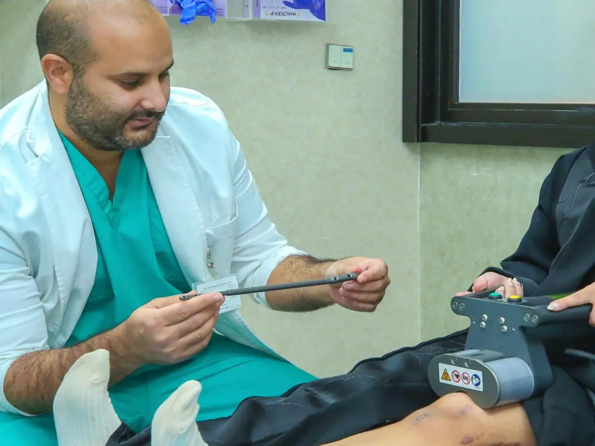 طرق إطالة العظام - المسمار النخاعي