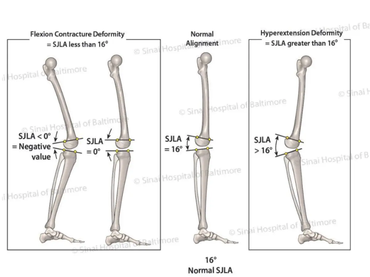 نشر بحث عن القياسات الطبيعية وطرق تحليل التشوهات الجانبية