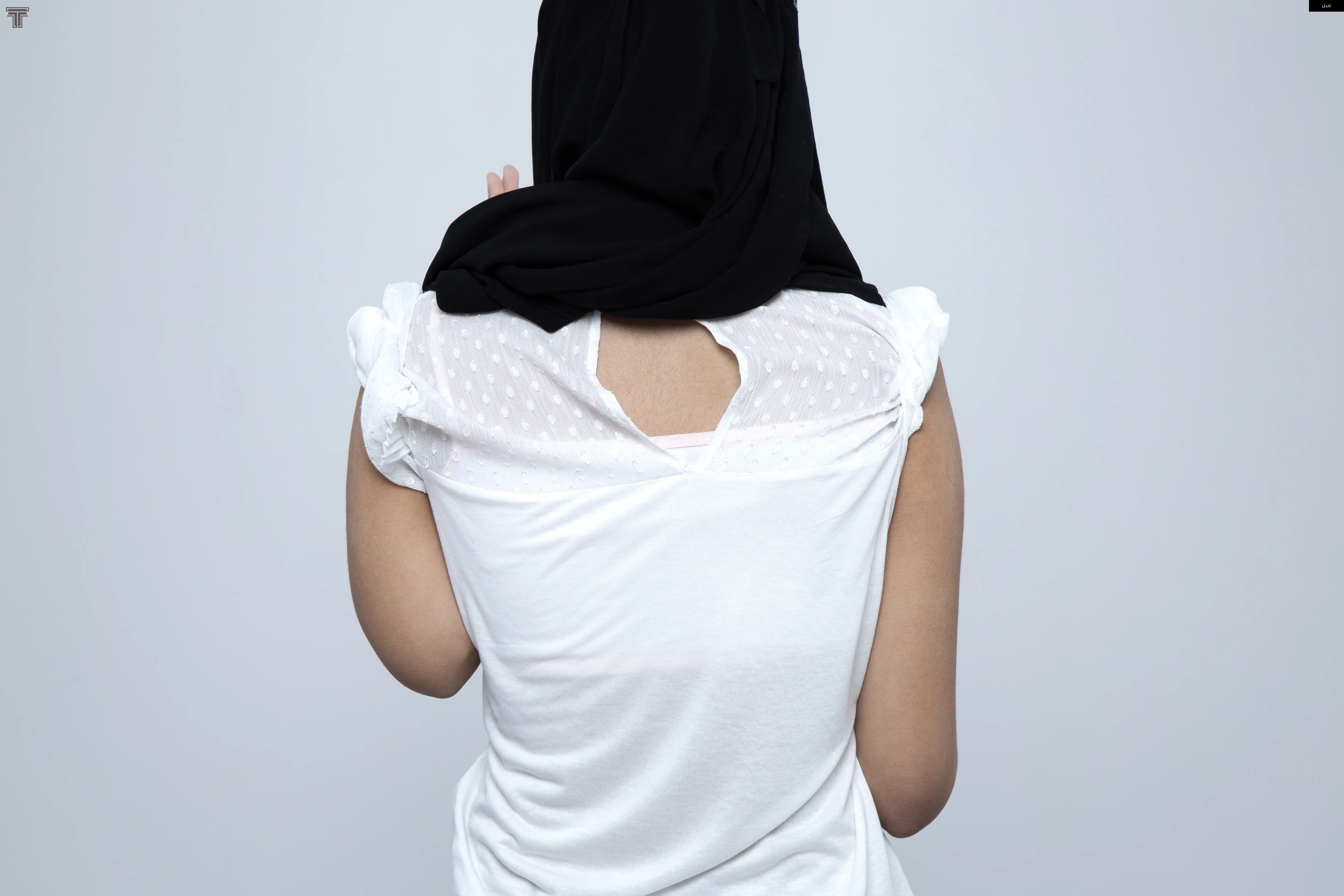 تطويل عظمة الساعد بسبب قصر ناتج عن التهاب مبكر اثناء الصغر في مركز النمو